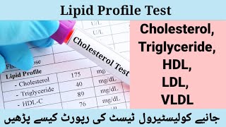 Fasting Lipid Profile Test  Blood Cholesterol Test Normal level  Triglyceride Test by Dr Abdullah [upl. by Nnel]