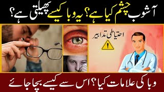 ashob e chashm  eye infection  eye drops  how to cure eye infection  Hospital eye viral news [upl. by Tena999]