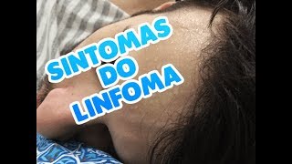 SINTOMAS DO LINFOMA [upl. by Esidnak]