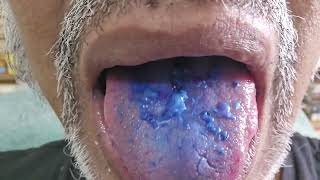 Worlds first video of a tongue coloured by anthocyanin edible pigment from Jamun fruits [upl. by Auqinaj791]