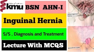 Inguinal Hernia in UrduHindi  Hernia and Its Types In Hindi  GIT Disorders  Adult Health Nursing [upl. by Wrench]