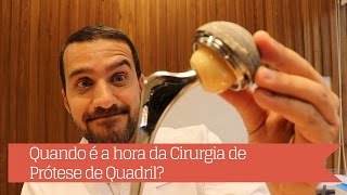 Quando é o momento de realizar a cirurgia de Prótese de Quadril [upl. by Marco917]