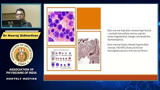 APPROACH TO PATIENTS WITH PANCYTOPENIA MAY 2023 [upl. by Pain]