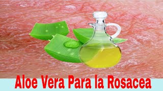 Qué tan Efectivo es el Aloe Vera Para la Rosácea [upl. by Eanahs]