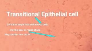 Epithelial cell types and its identification [upl. by Zamir646]