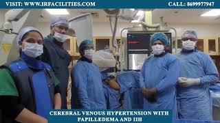 Stenting for Cerebral Venous Hypertension with Papilledema and IIH  IRFACILITIES [upl. by Cedric]