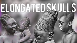 Head Elongation on Babiès  Mangbetu Tribe Shocking Tradition and Why they do it [upl. by Amelie]