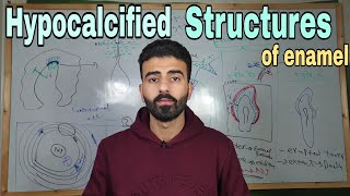 Enamel 4  hypocalcified structures of enamel  oral histology [upl. by Weibel]