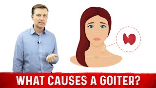 What Causes a Goiter Causes of Thyroid Enlargement – DrBerg [upl. by Ellenyl246]