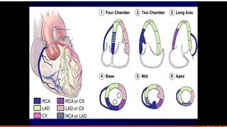 Ischaemic heart disease  Dr Ahmed Talaat [upl. by Gamali653]