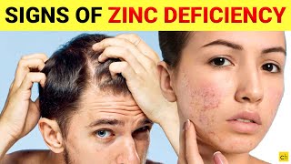 Do you know these 7 Shocking signs of Zinc Deficiency  Credihealth [upl. by Enineg]