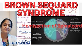 Brown Sequard Syndrome Hemisection of Spinal cord [upl. by Hong]