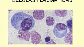 LEUCOCITOS NORMALES Y PATOLÓGICOSwmv [upl. by Halet]