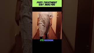 🤔 Can removing back pain REALLY help removing foot pain 🚶‍♂️ 🦶  drleefoot youtubeshorts [upl. by Dovev]