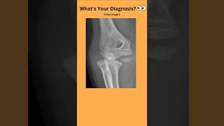 Whats Your Diagnosis 👀radiology radiography doctor nurse medicalstudent medicaltest [upl. by Genevieve384]