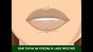 Cómo tratar un piercing de labio infectado [upl. by Bibbie]