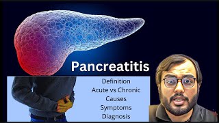 UNDERSTANDING PANCREATITIS LECTURE anatomyandphysiology [upl. by Nabois697]