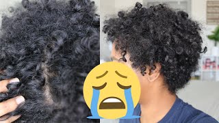 WHY I STOPPED USING DEVACURL 😩🥵  Devacurl Ruined My Hair amp Scalp W Pics [upl. by Wartow77]