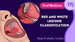 Red and White Lesions Classification  Full Video  Oral Medicine  Medi Study Go [upl. by Anniram]