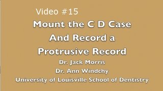 Video 15 C D Mount the Case amp Record a Protrusive Record [upl. by Hnahym]