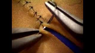 Basic Microsuture Technique [upl. by Hennahane]