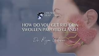 How do you get rid of a swollen parotid gland [upl. by Gladys424]