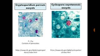 Para Findings 7 Cryptosporidium Cyclospora and Cystisospora in Stool with MZN stain [upl. by Lesab712]