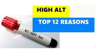 HIGH ALT LEVELS  TOP 12 REASONS [upl. by Julius]