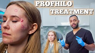 Profhilo Treatment  Dermal Filler For Fine Lines amp Wrinkles  Dr Somji amp Dr Solomon Demonstrate [upl. by Inafets]