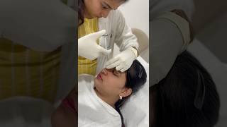 Instant Nose Makeover – NonSurgical amp Painless Rhinoplasty [upl. by Ennaeel]