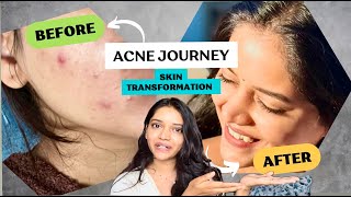 All about my SKINCARE  Shivani Yash Mathadhikari [upl. by Enetsirhc385]