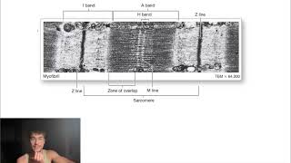 the sarcomere actin amp myosin and bands ep 2 [upl. by Benedetta912]