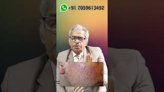 RED PIMPLES  Best homeopathy medicine  Dr P S Tiwari [upl. by Sidonie]