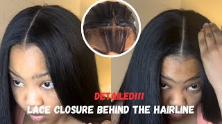 HOW TO LACE CLOSURE BEHIND THE HAIRLINE 💁🏾‍♀️ [upl. by Schweitzer]