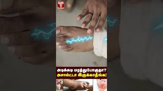 கால் மரத்து போவதன் காரணம் இதுதான்  உடனே கவனிவுங்கள்  Reason for leg numbness  Leg pain [upl. by Streeter]