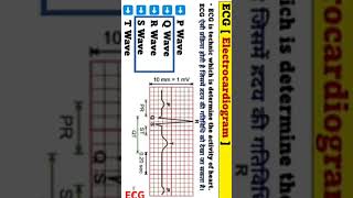 Electrocardiogram ECG [upl. by Regina247]