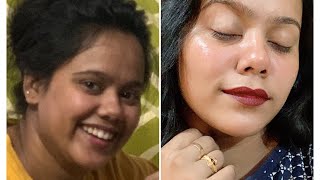 My Extreme FACE Transformation SUCCESS STORY successstory [upl. by Adiene]