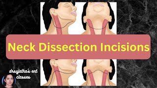 228Incisions used for Neck Dissection surgeryeducation dentallectures [upl. by Ellehsem]