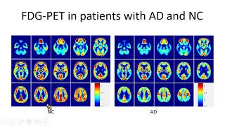 Neuroimaging in dementia Taiwan experience 徐榮隆 [upl. by Rene796]