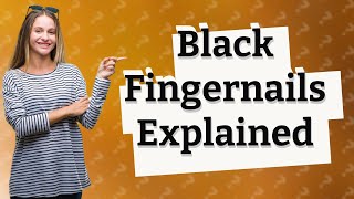 What does it mean when someone has a black fingernail [upl. by Ddart224]