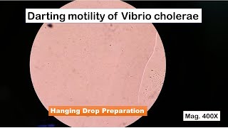 Darting motility of Vibrio cholerae in Hanging Drop preparation [upl. by Amian]