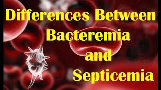 bacterial infection of blood complication of inflammation [upl. by Yenal]