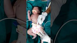 Cute newborn at birth injection 😍babypictures ytshorts shortsvideo viralvideo newborn [upl. by Ilek]