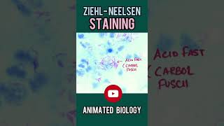 ZiehlNeelsen ZN stain  What we can identify using ZN stain  Microbio in 1 minute [upl. by Eagle307]