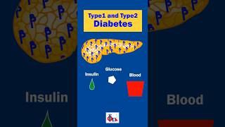 Type1 and Type 2 Diabetes  Know the difference DrTulip  JP Nagar [upl. by Berti]