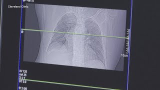 US Surgeon General issues new warning about lung cancer [upl. by Riha762]