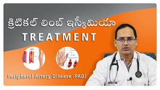 Critical limb ischemia  Angioplastystent  In Telugu  Dr BV Narayana Reddy  SHRI Hospital [upl. by Palmira734]