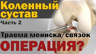 Делать ли пластику связок  мениска коленного сустава S05E13 [upl. by Joacimah]