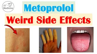 Metoprolol amp Beta Blockers Weird Side Effects Skin Gastrointestinal Psychological [upl. by Sitsuj]