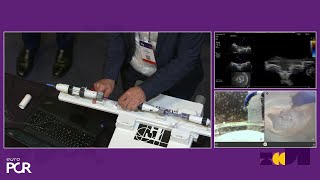 PASCAL Precision system simulation showcase grasp the difference EuroPCR 2024 [upl. by Mateya]